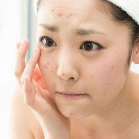 da dễ mẫn đỏ phải làm sao