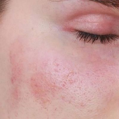so sánh kem chống nắng vật lý và hóa học