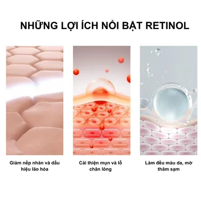 Có nên dùng retinol