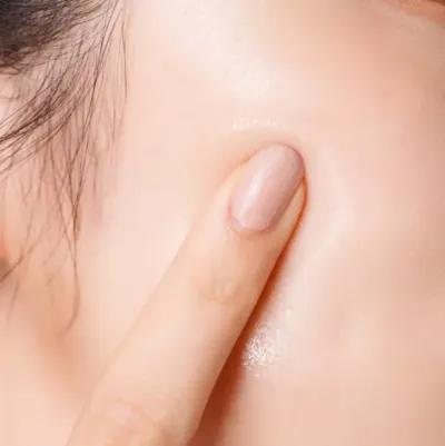 Có nên dùng niacinamide