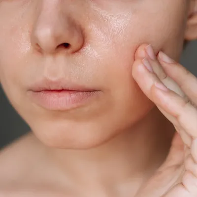tại sao da đổ dầu