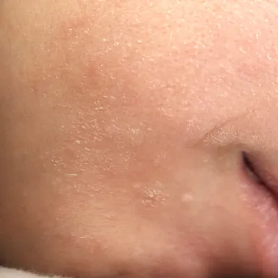 có nên dùng toner