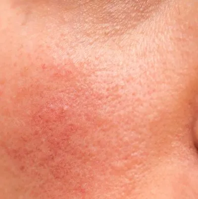 gel rửa mặt