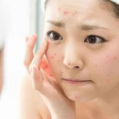 da bị quá tải