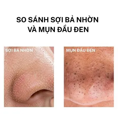 sợi bả nhờn