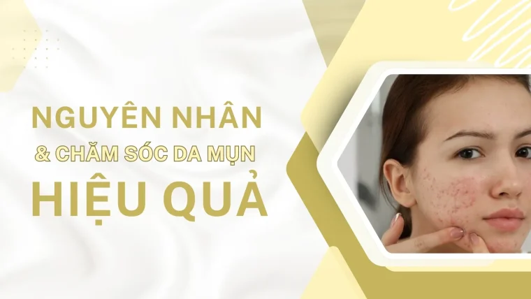 chăm sóc da mụn