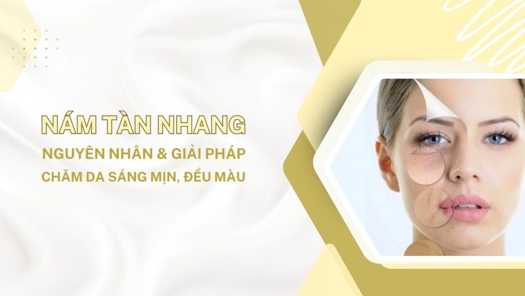 nám tàn nhang nguyên nhân và giải pháp