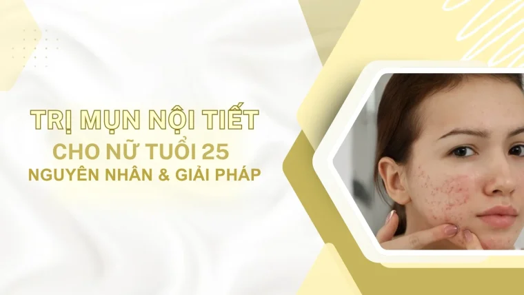 Trị mụn nội tiết cho nữ tuổi 25