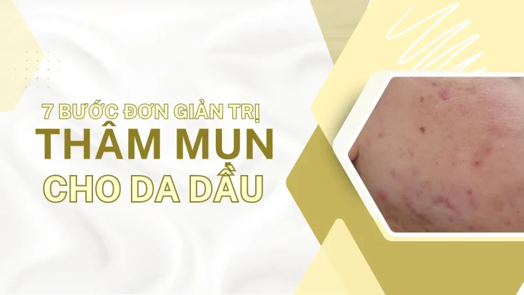 Cách trị thâm mụn