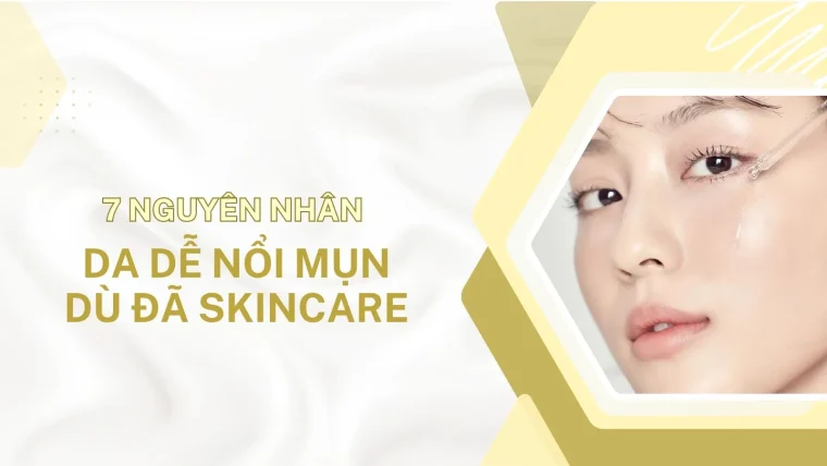 Nguyên nhân da dễ nổi mụn