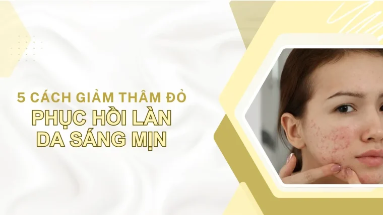 giảm thâm đỏ sau mụn