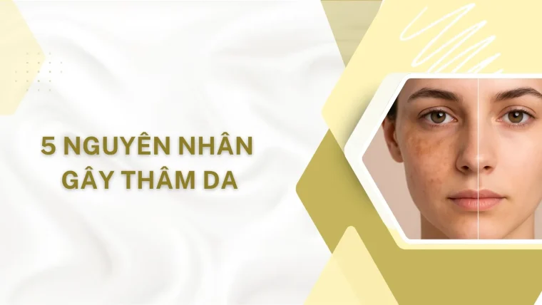Nguyên nhân gây thâm da