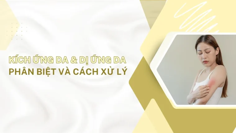 phân biệt kích ứng da và dị ứng da