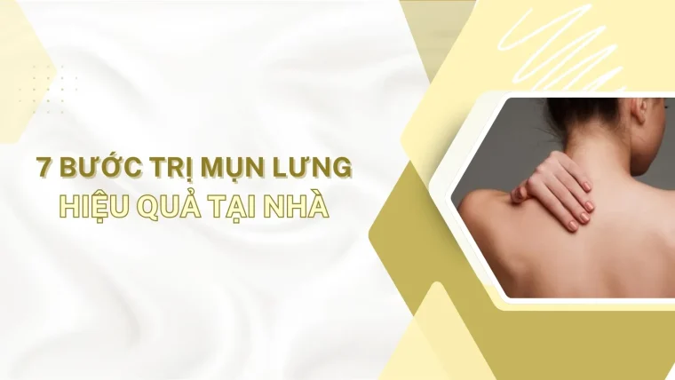 Trị mụn lưng