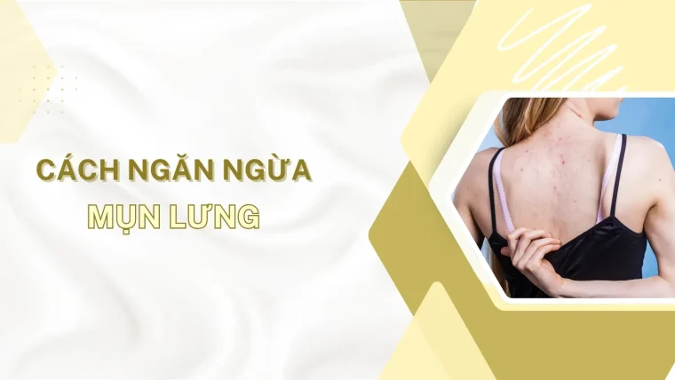 Cách ngăn ngừa mụn lưng