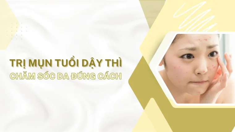 Trị mụn tuổi dậy thì