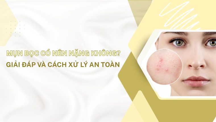 mun bọc có nên nặng không