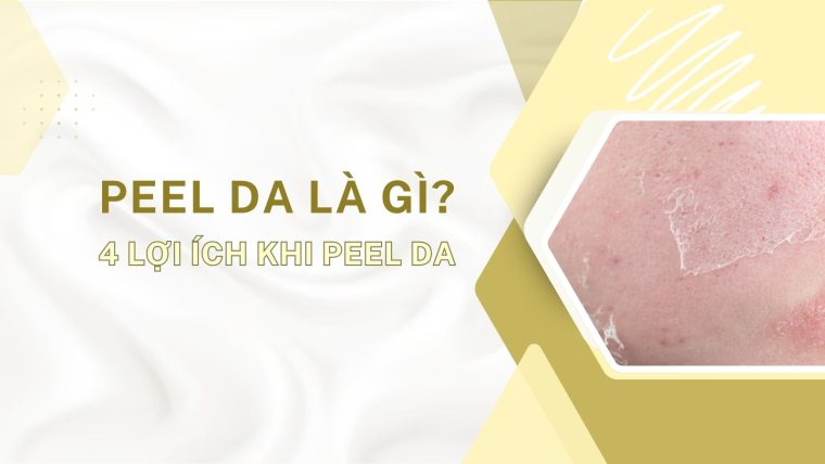 peel da là gì