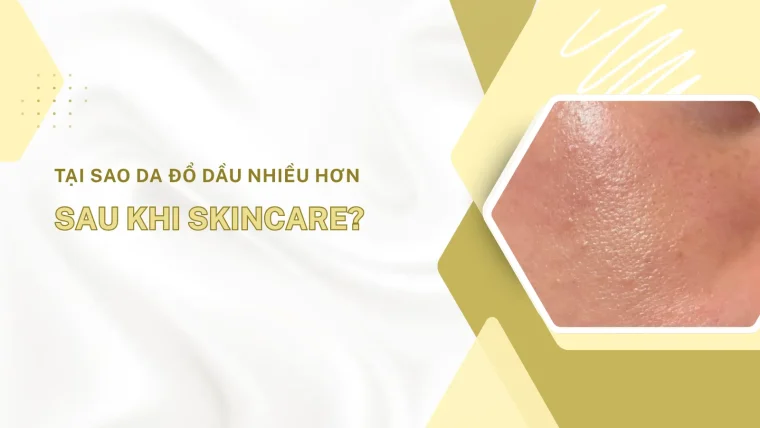 tại sao da đổ dầu