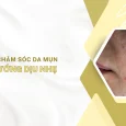 chăm sóc da mụn