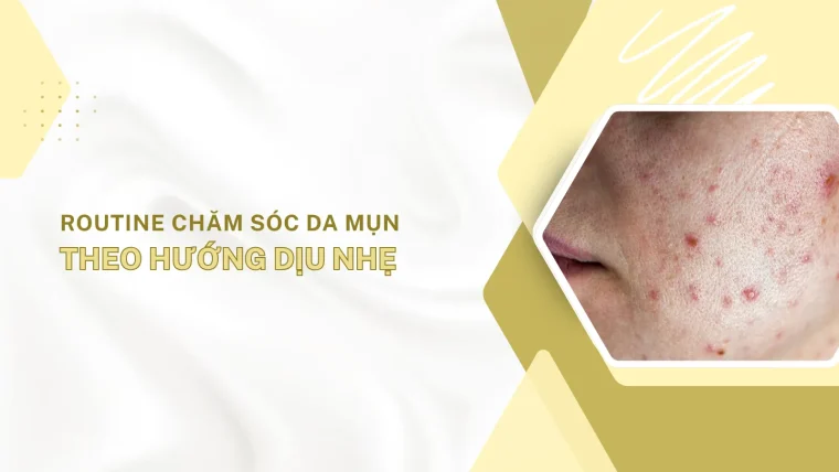 chăm sóc da mụn