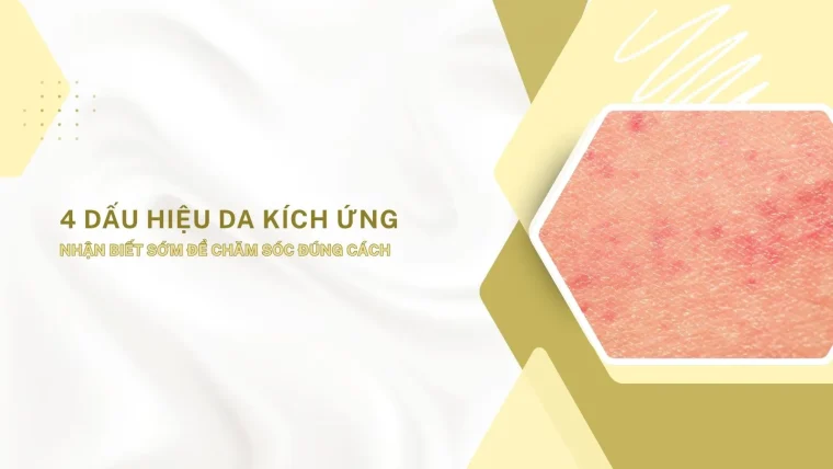dấu hiệu da kích ứng