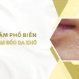 chăm sóc da khô