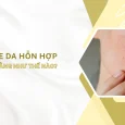 da hỗn hợp