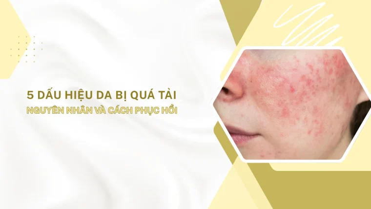da bị quá tải