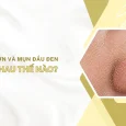 sợi bả nhờn